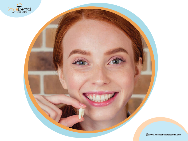 Simple Tooth Extractions: What You Need to Know