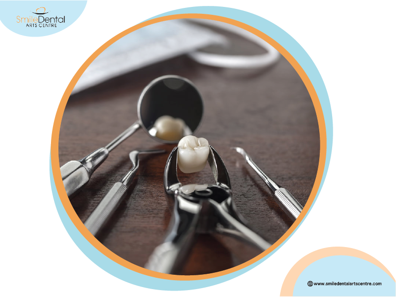 Simple Tooth Extractions: What You Need to Know
